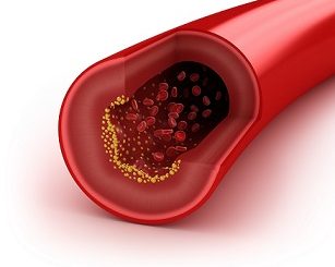 Cholesterol