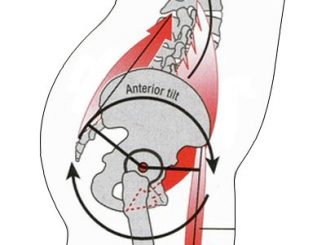 Anterior pelvic tilt diagram
