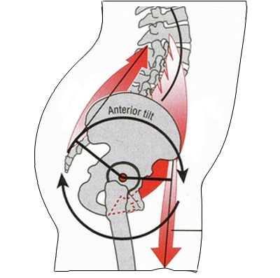 Anterior pelvic tilt diagram