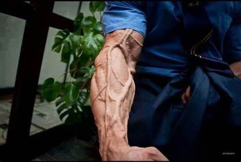 Vascular arm