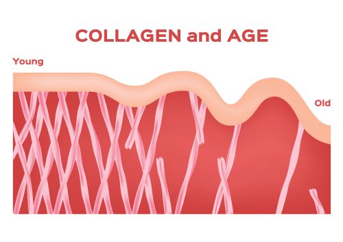 Collagen and Age